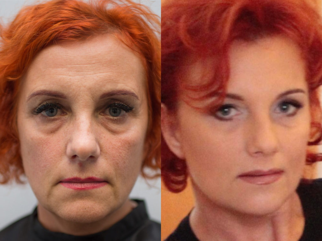 Kezelés előtte utána