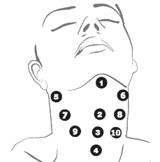 Profhilo nyak kezelés ábra