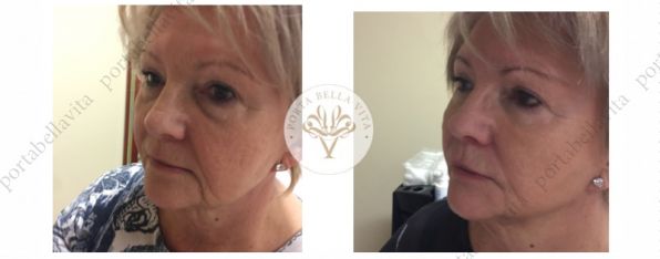 Arcfiatalitas mutet nelkul1