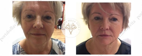 Arcfiatalitas mutet nelkul2