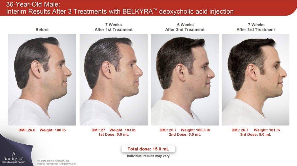Ba belkyra1 1500x842 1