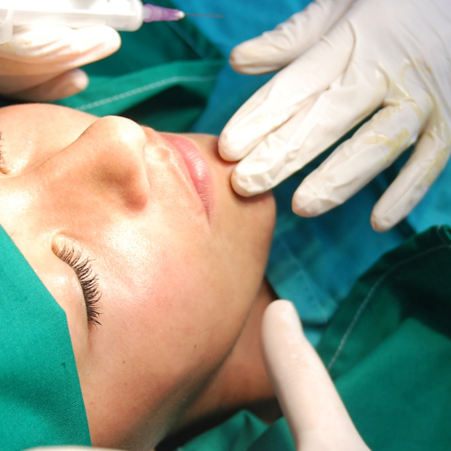 Lip lift Dr Járai Tamás