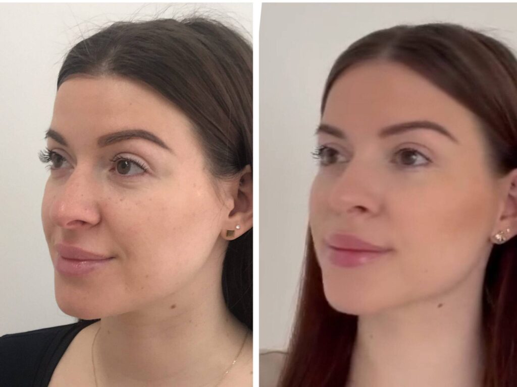 Beautyficatio
